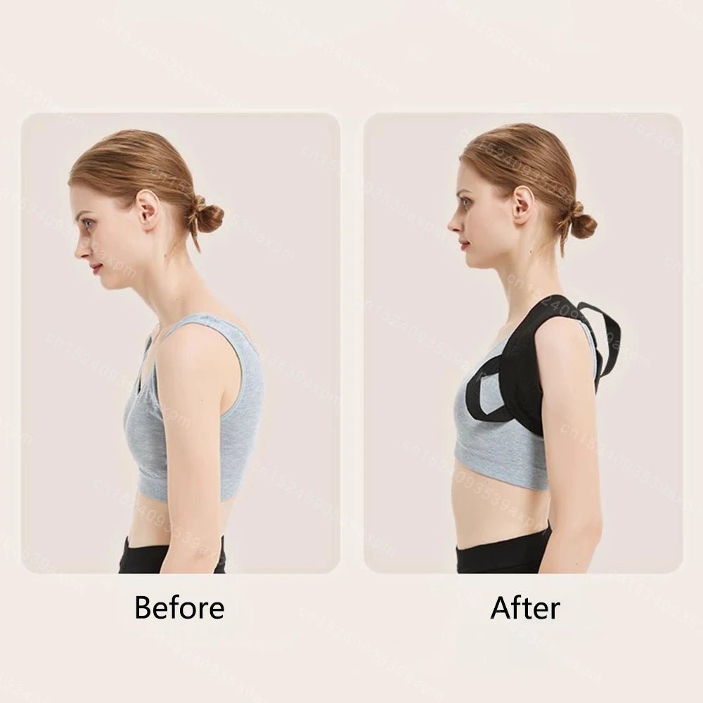 Back Posture Corrector – Adjustable Clavicle & Spine Support Belt for Upper Back, Shoulder, and Lumbar Alignment (Unisex)