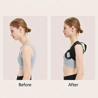 Back Posture Corrector – Adjustable Clavicle & Spine Support Belt for Upper Back, Shoulder, and Lumbar Alignment (Unisex)